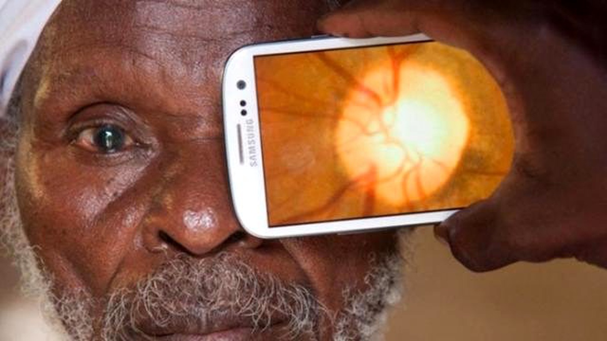 Peek Retina: Akıllı Telefonda Göz Muayenesi