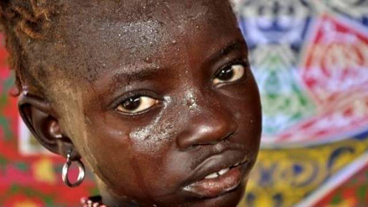 Sudan\'da AİDS Vakaları Artıyor