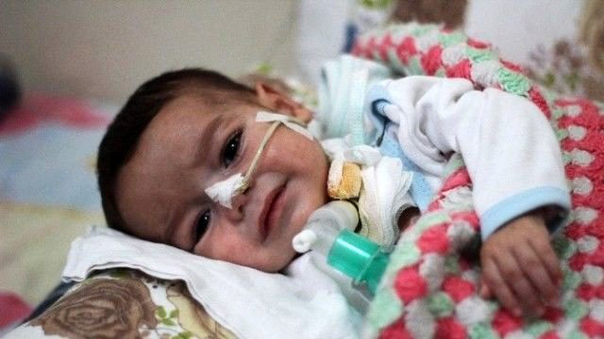Minik Ceyhun\'un Dramı Yürekleri Dağlıyor