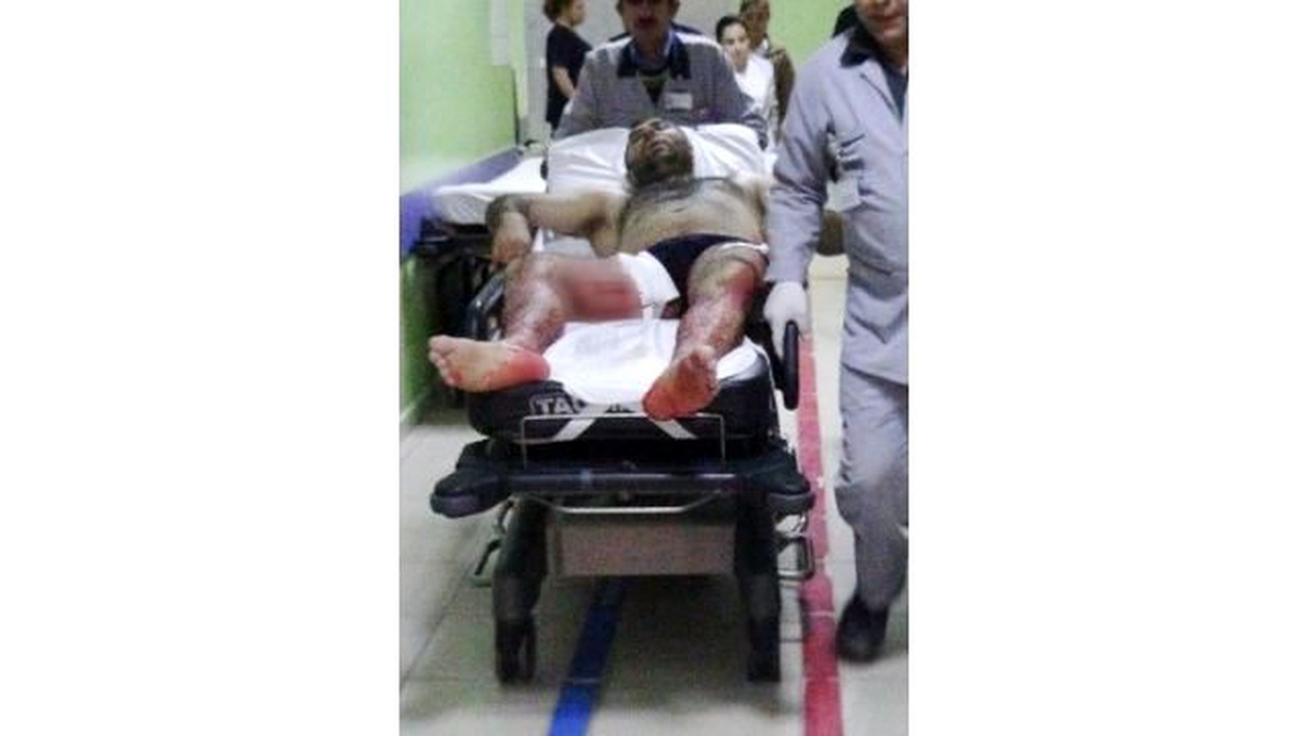 İşçilerin Çay Kavgası Kanlı Bitti: Dört Yaralı