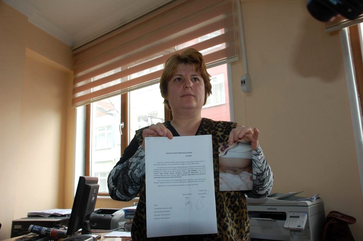 Tekirdağ\'da 3,5 Yaşındaki Çocuğun Kreşte Darbedildiği İddiası
