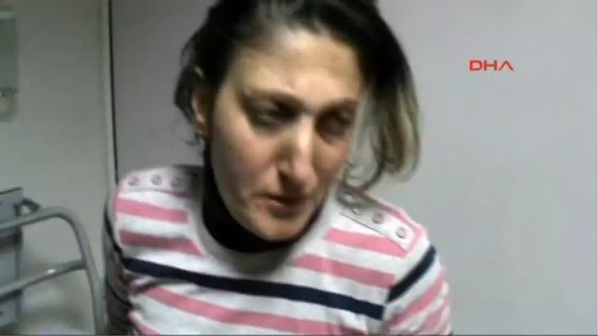 Samsun\'da İpini Koparan Köpek Kadınlara Saldırdı: 3 Yaralı