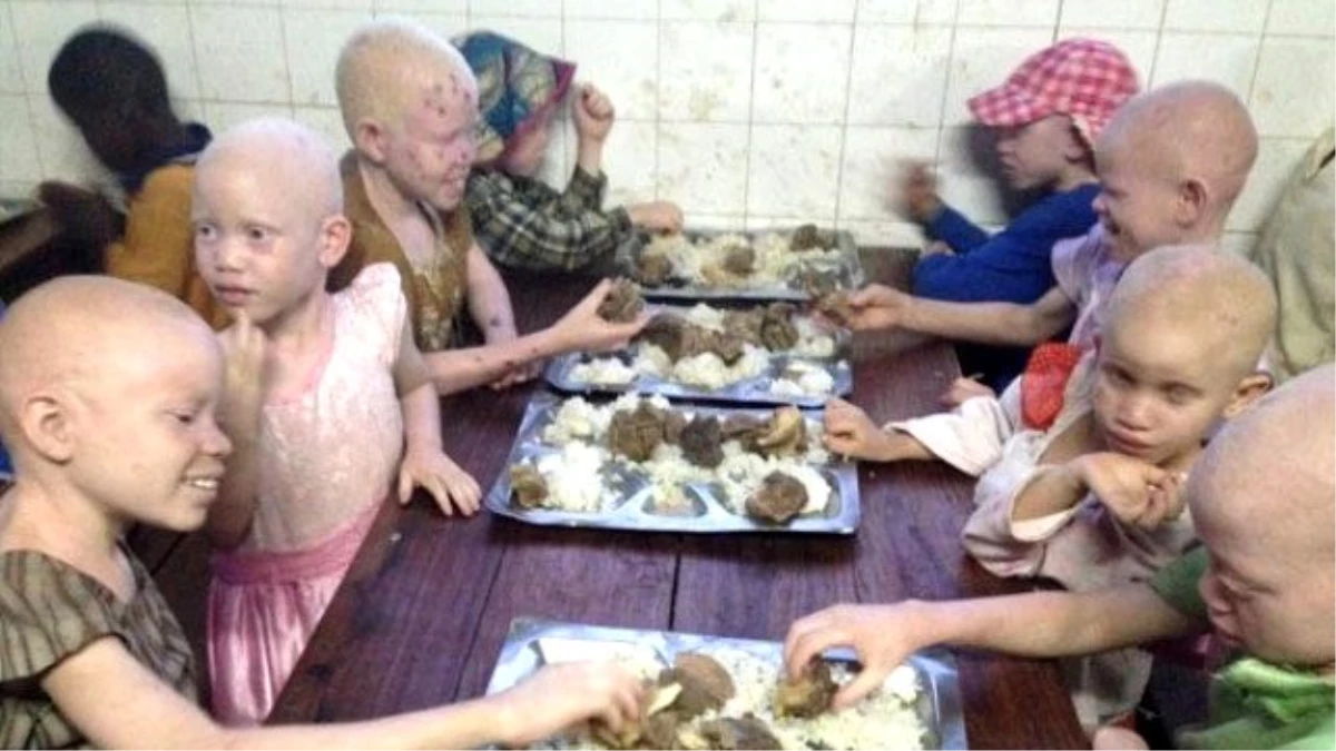 Burhaniye Belediyesi "Albino Köyü"ne Destek Olacak