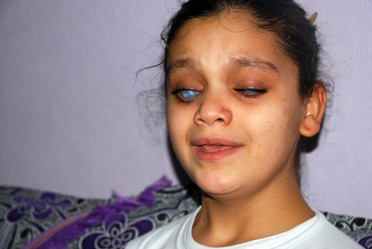 Doğuştan Görme Engelli Kardeşler, \'Işık\' İçin Yardım Bekliyor