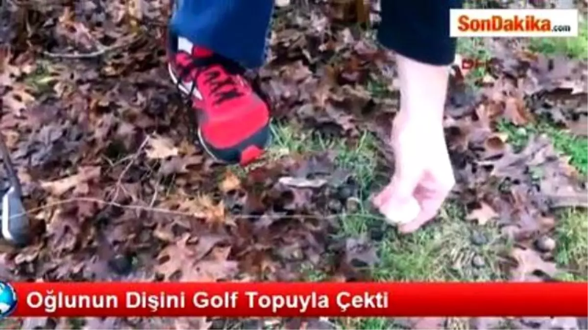 Babası, Oğlunun Dişini Golf Topuyla Çekti!