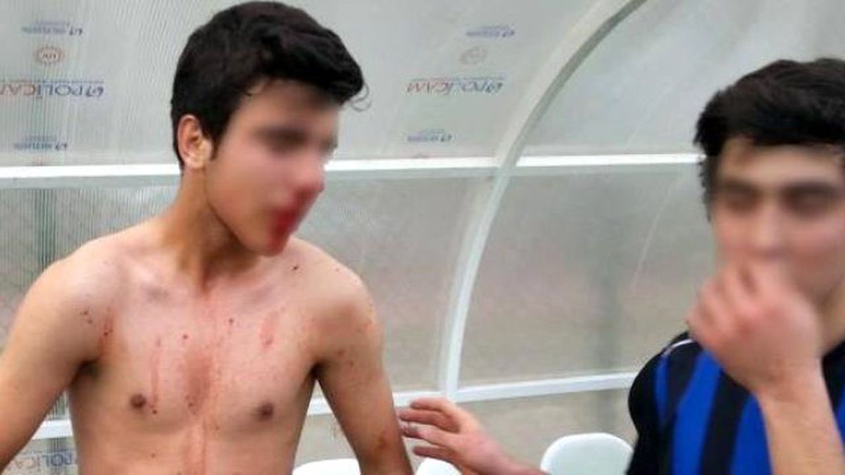 Amatör Maçta Çıkan Kavgada 2 Yaralı