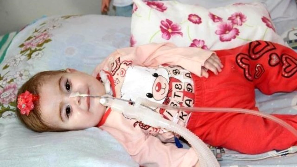 Ece Nur Bebek 5 Milyarda Bir Görülen Hastalıkla Savaşıyor