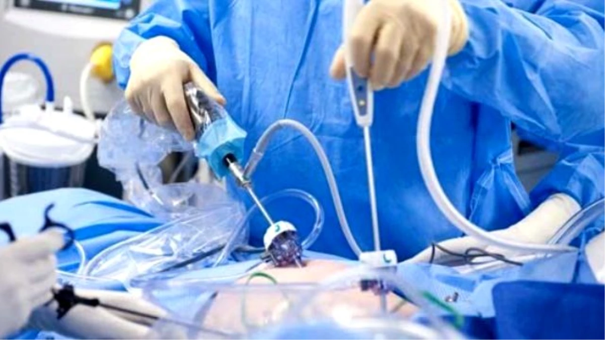 Elbistan\'da Kapalı Yöntem Karaciğer Ameliyatı Yapıldı