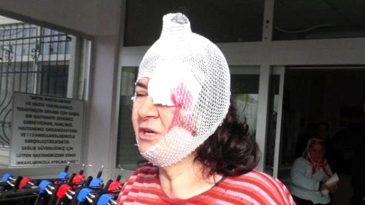 Eşi ve Kayınbiraderi Tarafından Dövülen Kadın Hastanelik Oldu