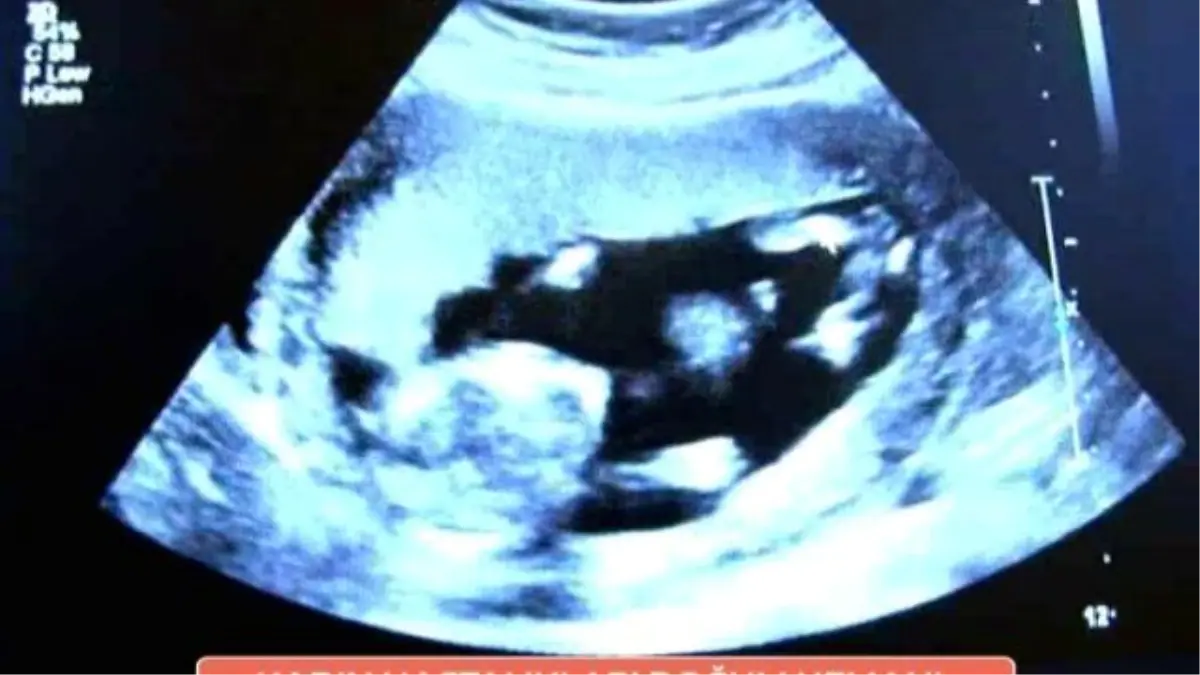 Kaç Haftalık Hamileyim ? Gebelik Haftası Hesaplama