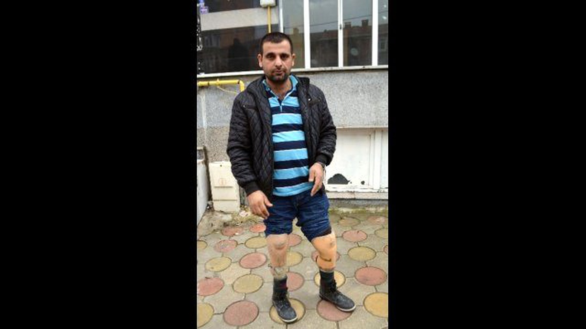 Protez Bacak İçin Yardım Bekliyor