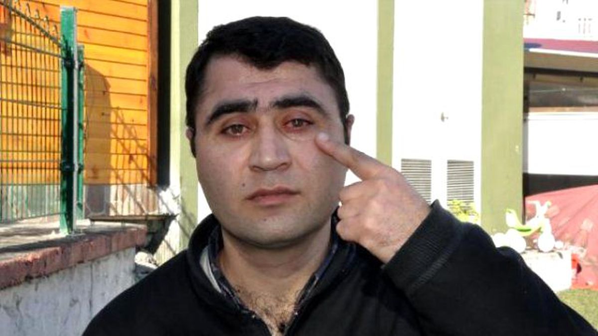 Tünel İnşaatında Gözünü Kaybetti