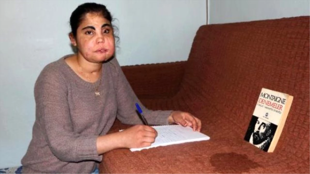 Türkiye\'nin Yüz Nakli Yapılan İlk Kadını Hayatını Yazdı
