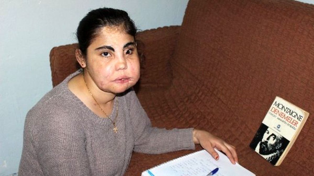 Yüz Nakilli İlk Kadın Hasta Hatice, Kitap Yazdı