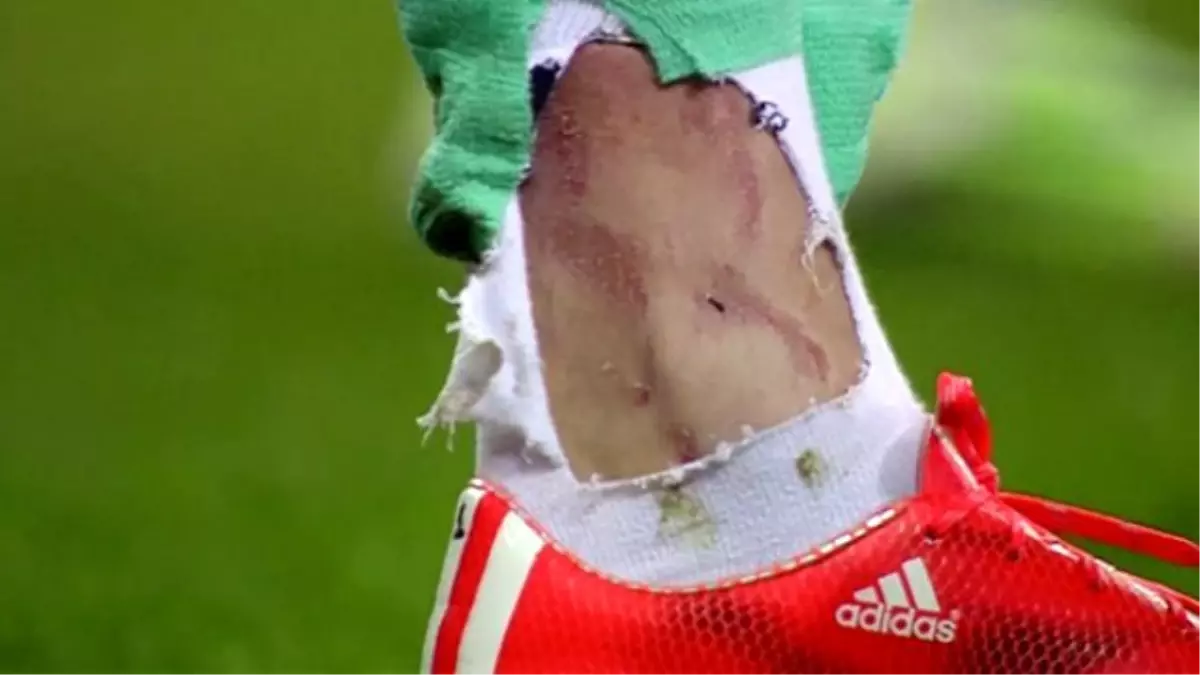 Beşiktaşlı Cenk Gönen, Darbeyi Ucuz Atlattı