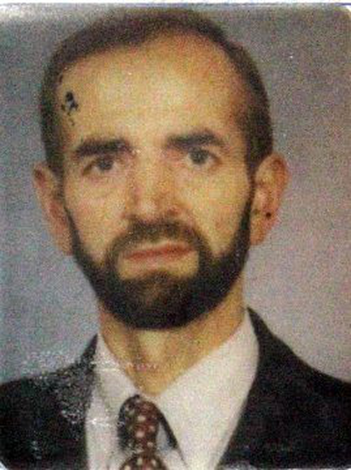 Otomobiliyle Direğe Çarpan Emekli İmam 72 Gündür Tedavi Gördüğü Hastanede Öldü