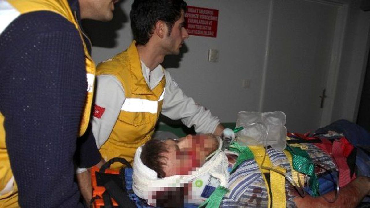 Asansör Tamircisi Asansör Boşluğuna Düşerek Yaralandı