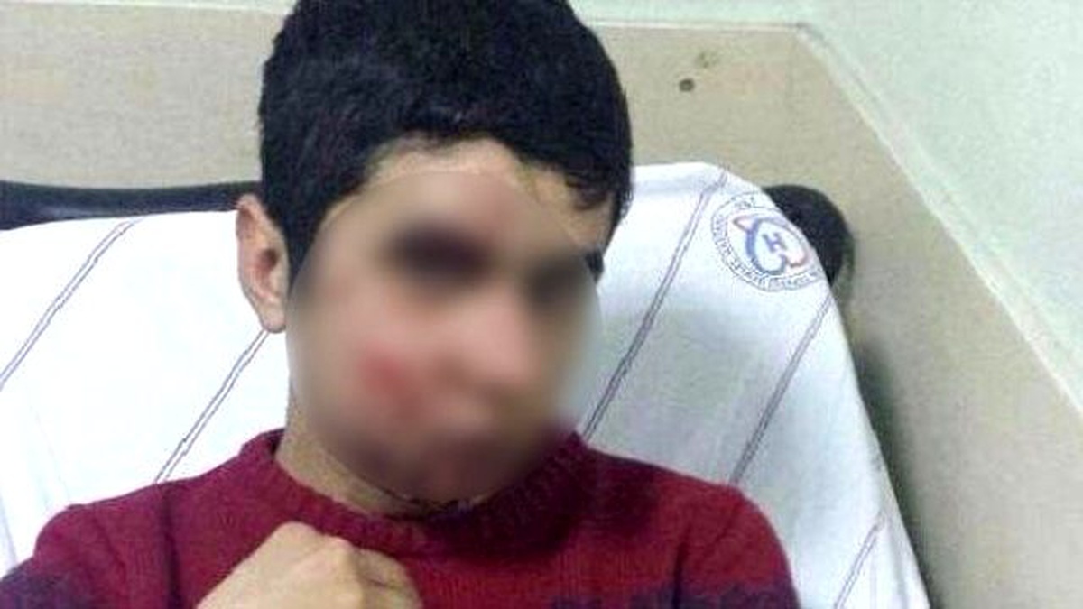 Gaz Kapsülü Değil Taş Yaraladı