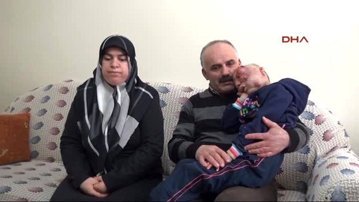 Mercimek Tanesi Büyüklüğündeki Kitle Yanlış Tedavi ile Yüzüne Yayıldı