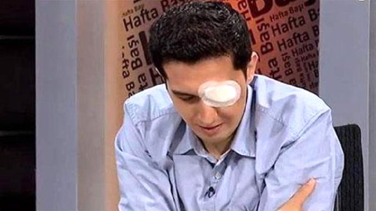 Footage Shows Police Firing Teargas Canisters That Makes Blind Research Assistant
