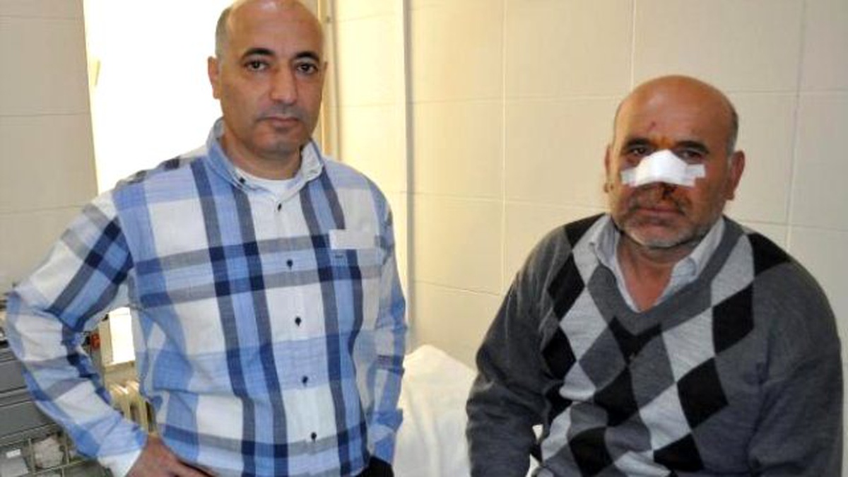 Burnu Kesilince 5 Hastane Gezen Hastaya 2 Gün Gecikmeli Dikiş Atıldı