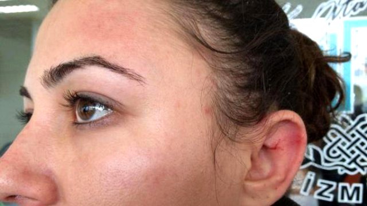 Burcu\'yu, \'Kadınlar Günü\'nde Boşanma Davası Açtığı Eşi Dövdü