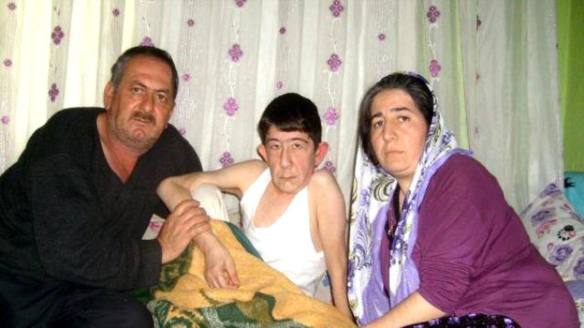 Tıpta Milyonda Bir Görülen Hastalık 16 Yaşındaki Orhan\'ı Buldu