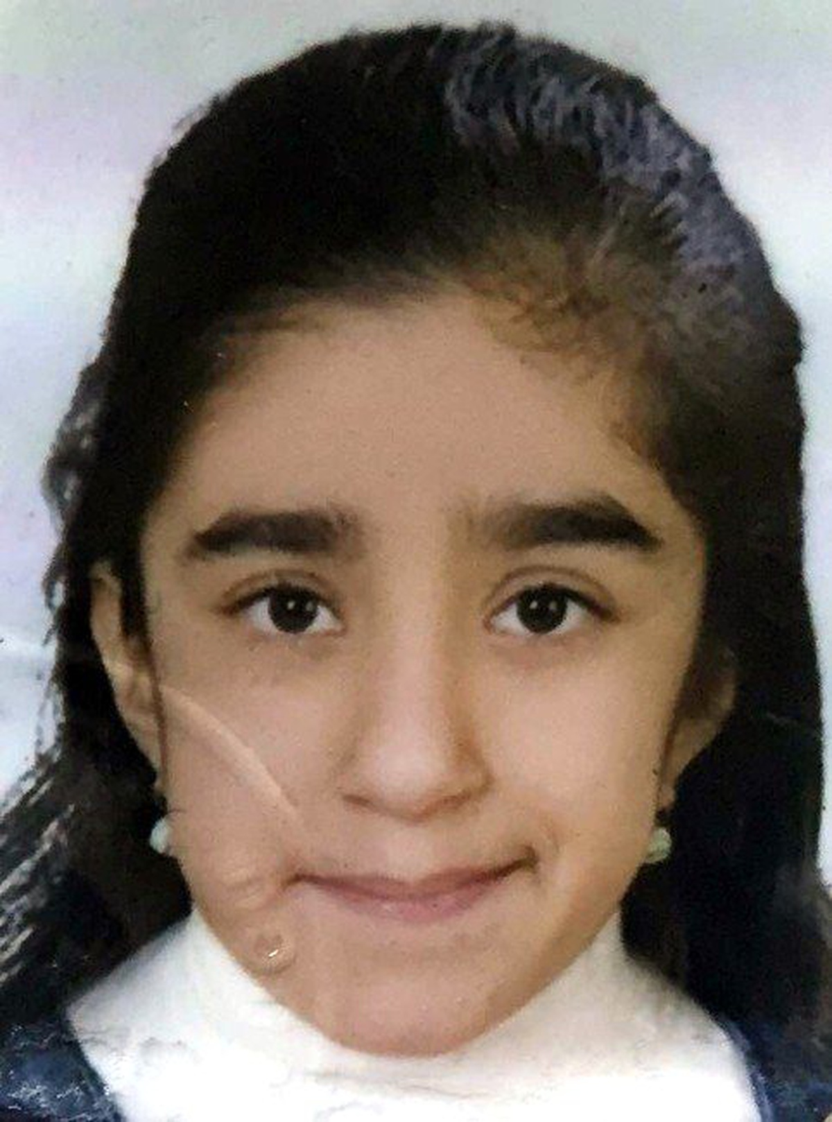 15 Yaşındaki Hatice Beyin Tümörüne Yenildi
