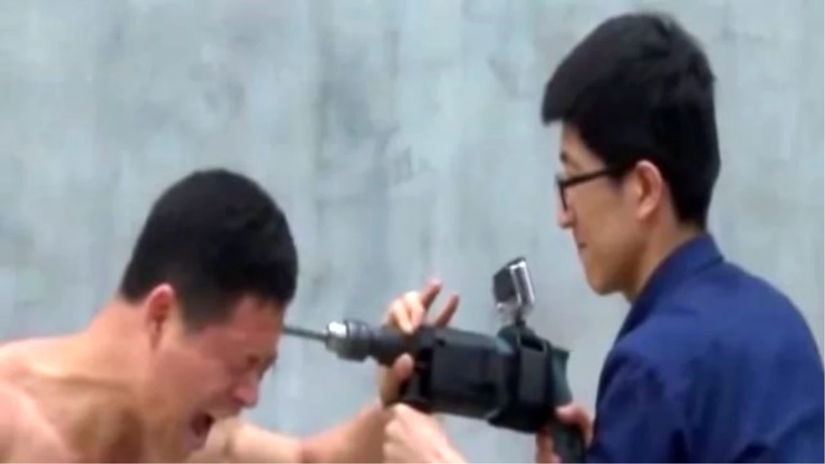 İnanılmaz Ama Gerçek! Çinli Adam Matkapla Kafasını Deldi