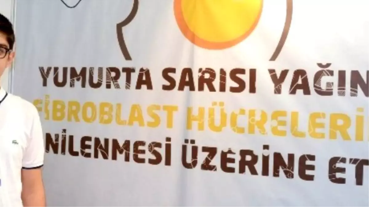 Erzurumlu Öğrencinin Başarılı Projesi