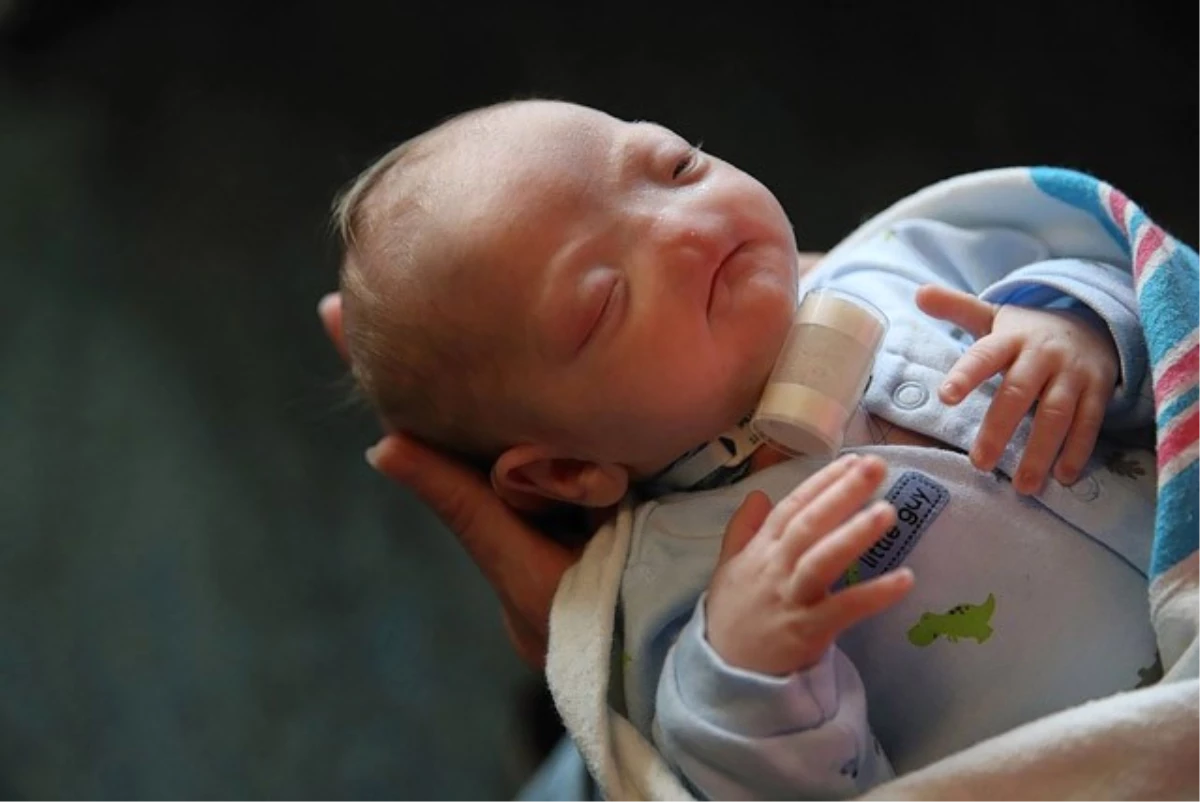 Facebook, Burunsuz Doğan Bebek Fotoğrafı Yasağını Kaldırdı