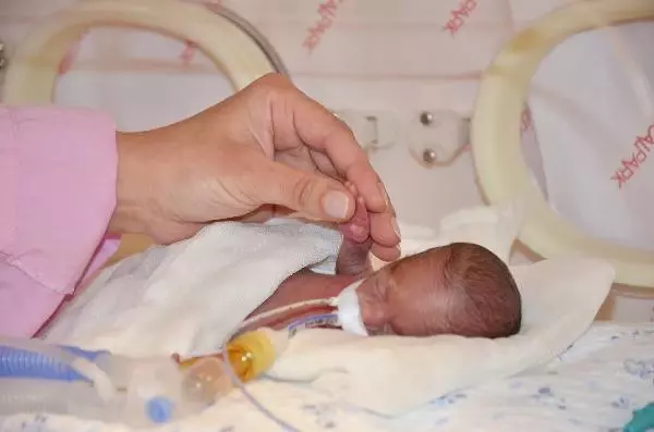 23 haftalik dogan diren bebek ile annesinin ilk dokunus heyecani son dakika