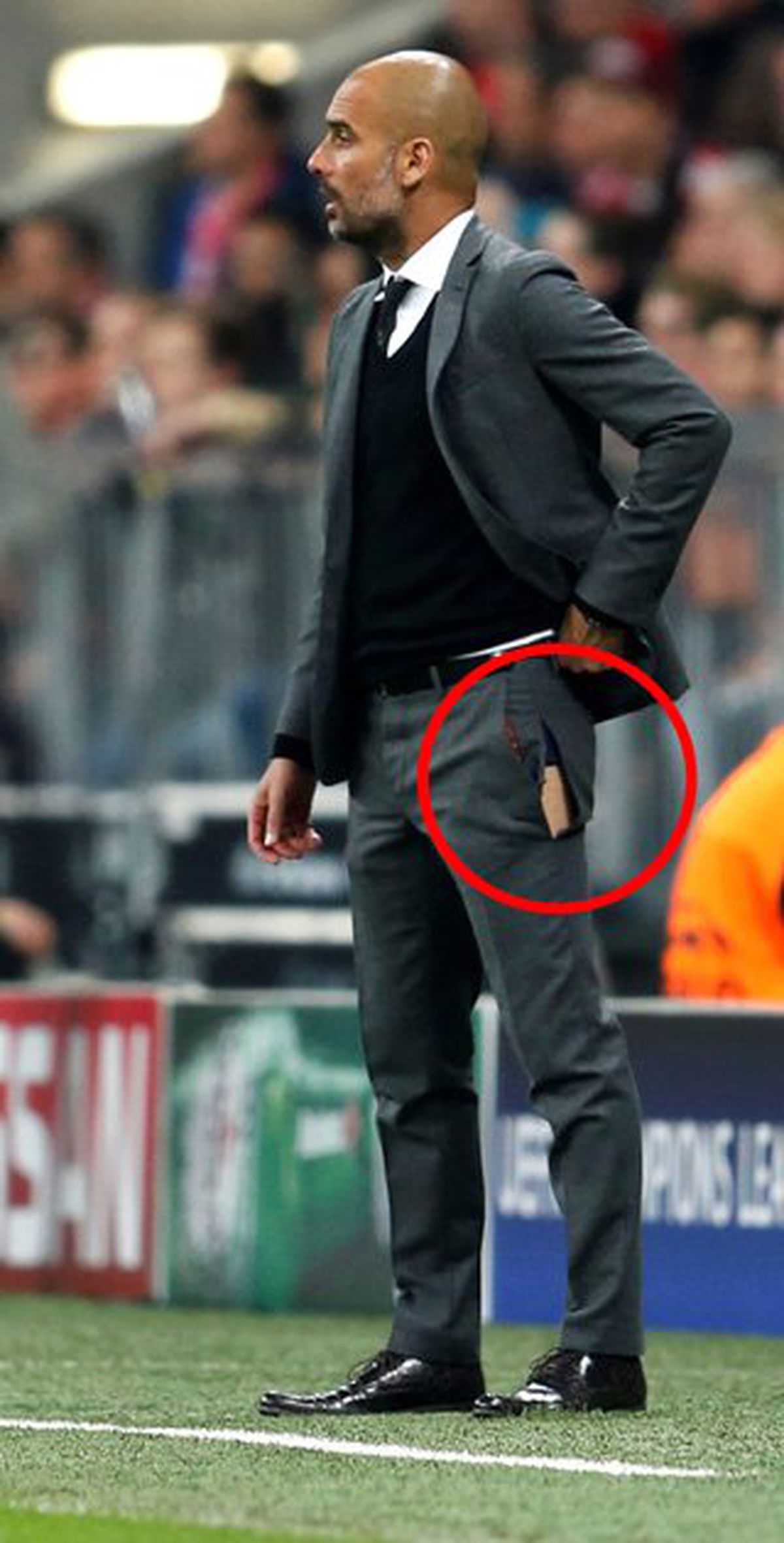 Guardiola'nın Pantolunu Yırtıldı, Karizması Sarsıldı