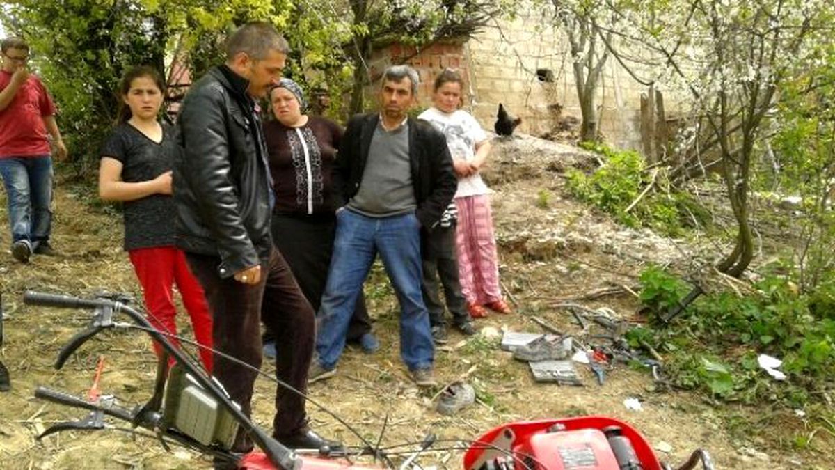 Ayağını Çapa Makinesine Kaptırdı