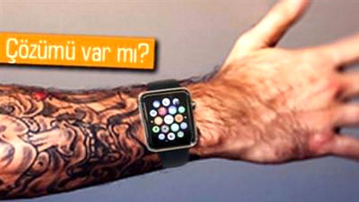 Apple, Apple Watch\'un Dövme Sorununu Onayladı