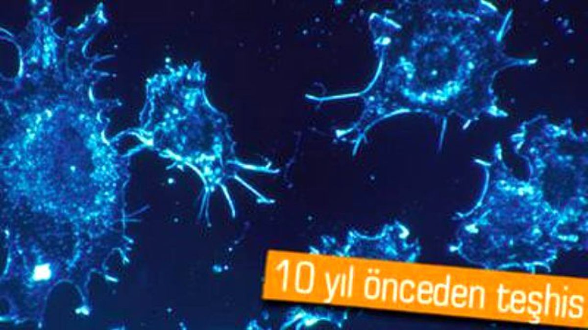 İnsan Boynundan Kanser Teşhisi!