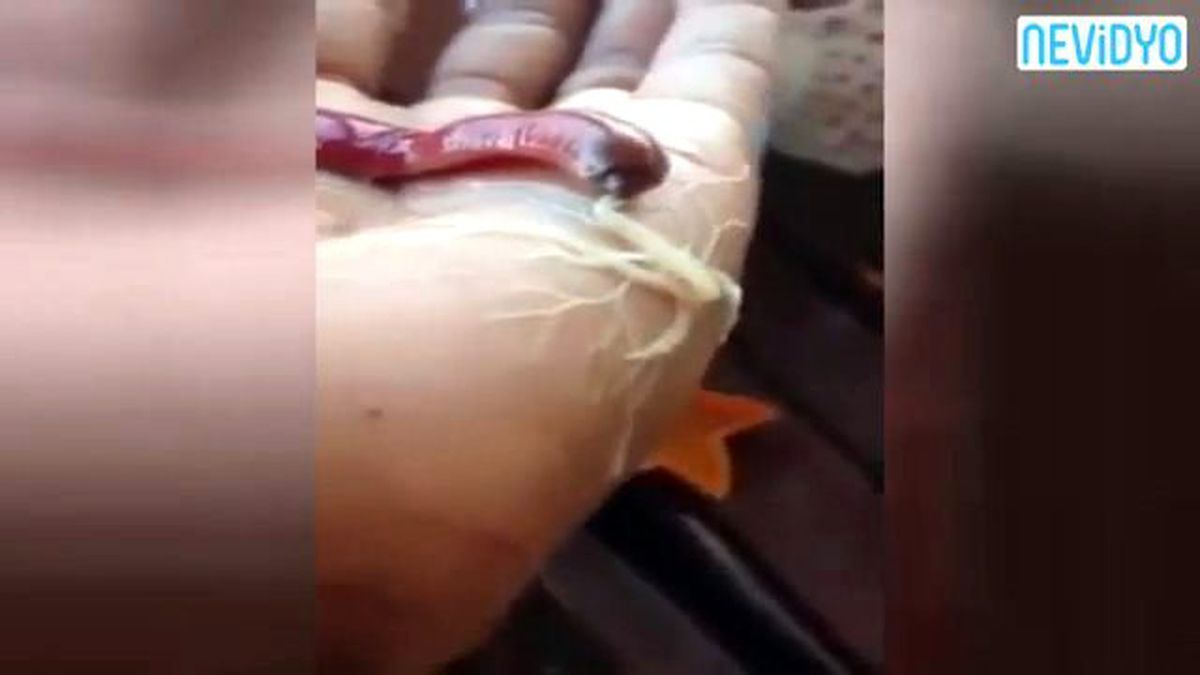 Solucandan Ürküten Hareket