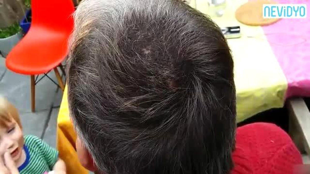 3 Saniyede Kel Kaldı!