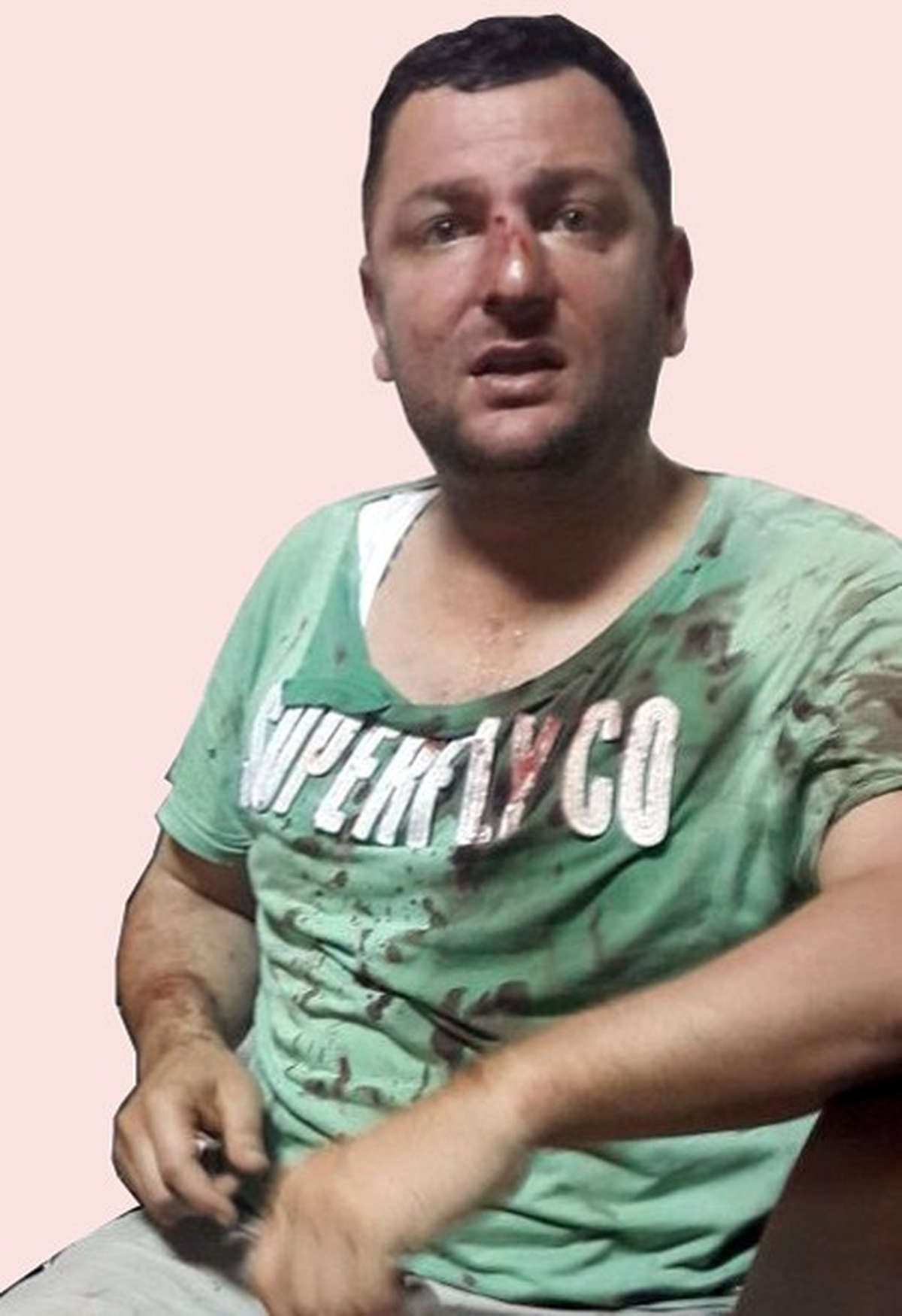Deliyle Şaka Kanlı Bitti