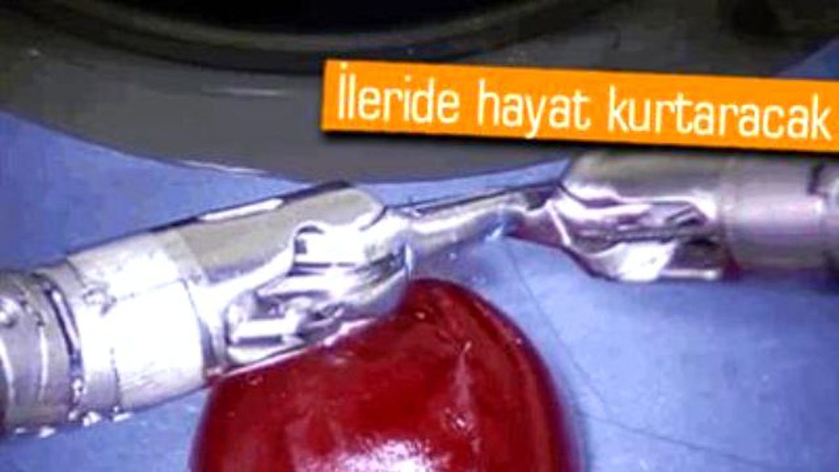 Mini Robot Bir Üzümün Kabuğunu Dikti!