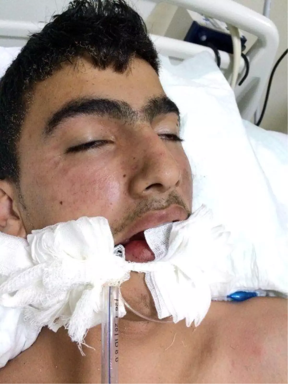 Parti Bayrağı Asan Suriyeli Çocuğa Elektrik Çarptı