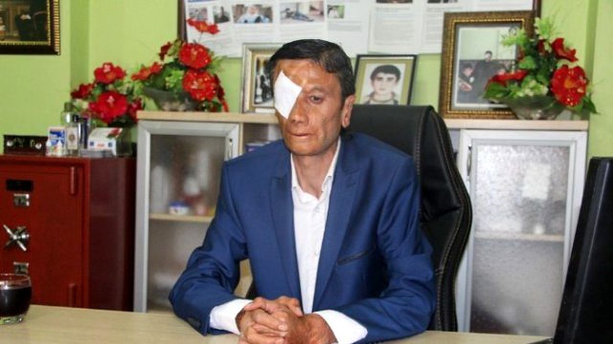 Süer\'den Engellilere Sahip Çıkılsın İsteği