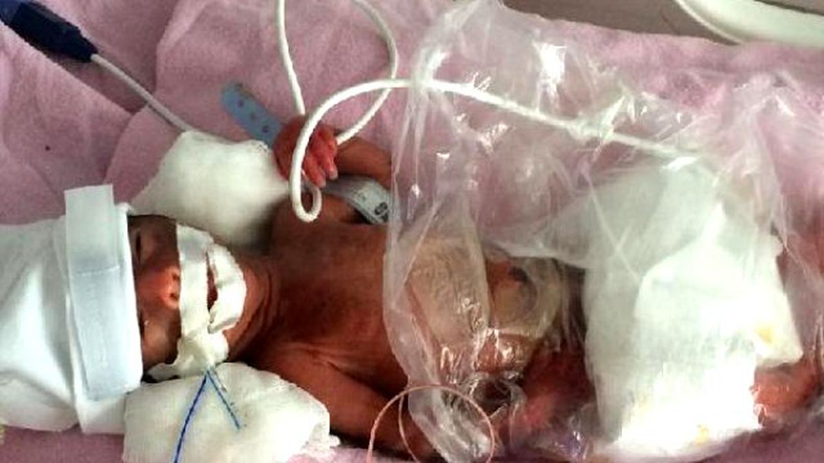670 Gram Doğan Bebek Helikopterle Ankara\'ya Sevk Edildi