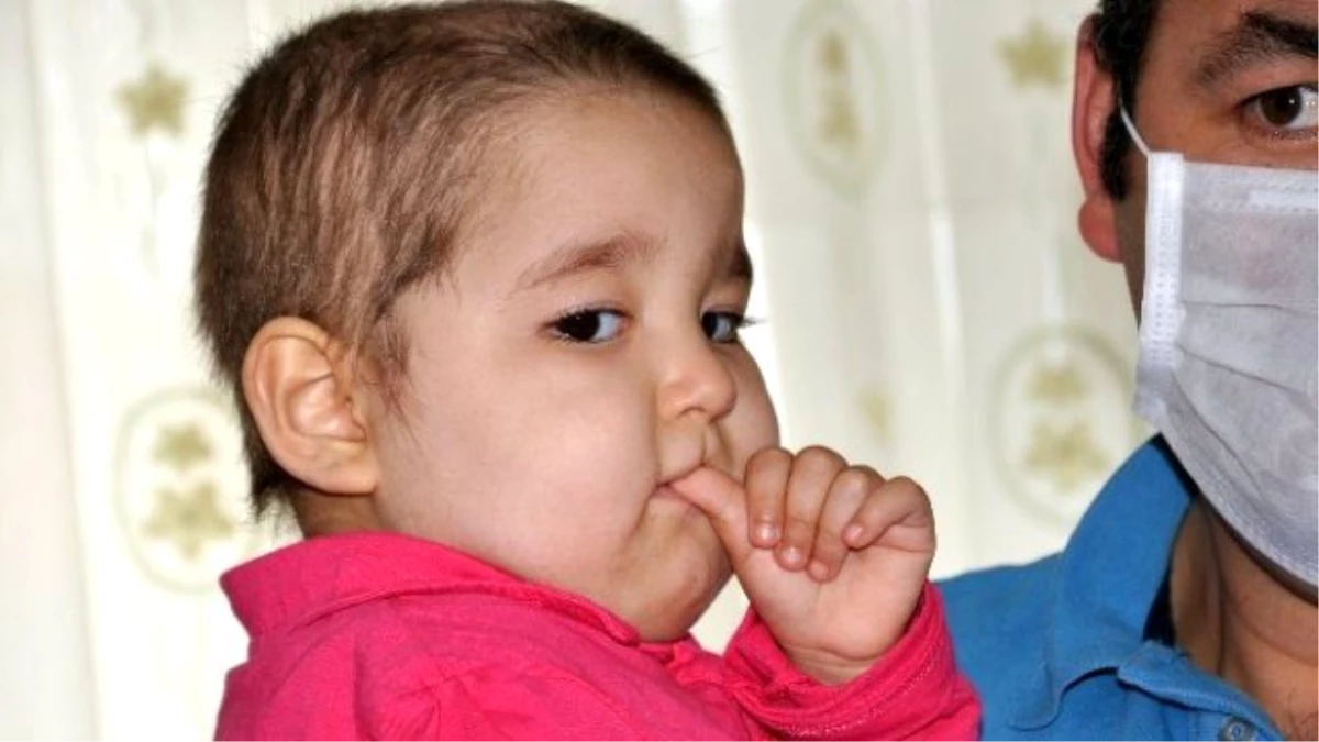 Bolu\'da Kemik İliği Hastası Minik Zeynep Uygun İlik Bekliyor
