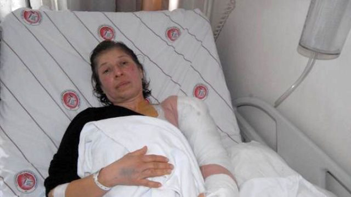 İki Göstericinin Kolunu Kıran Toma\'daki Polislere, Soruşturma İzni Çıkmadı
