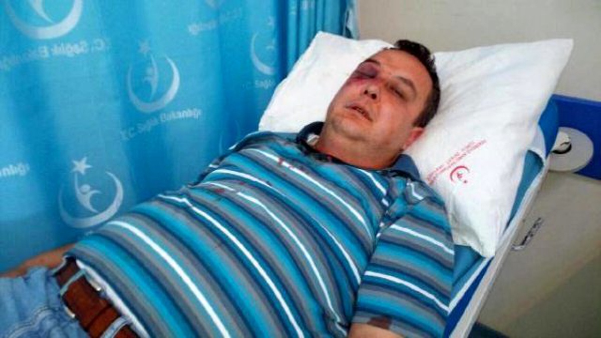 Suyu Kesilen Kuaför, Görevliyi Hastanelik Etti