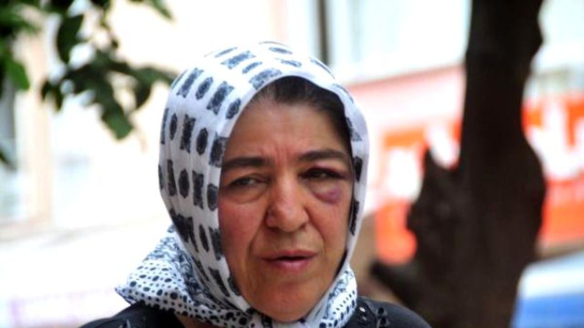 Birlikte Yaşadığı Adamla Gördüğü Annesini, Sokak Ortasında Dövdü