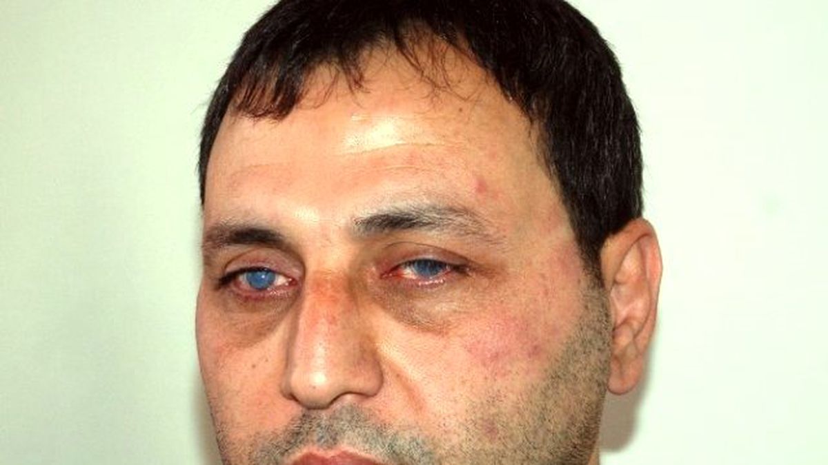 29 Yaşından Sonra Dünyası Karardı