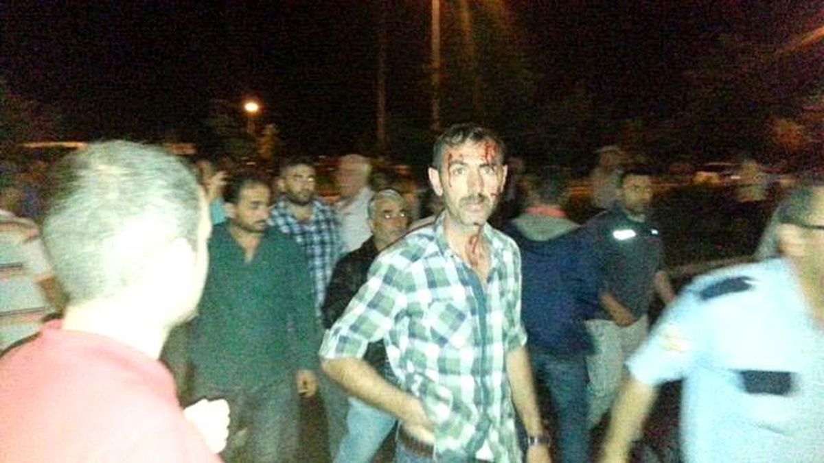 Giresun\'da Kamyon Minibüs Durağına Girdi: 1 Yaralı