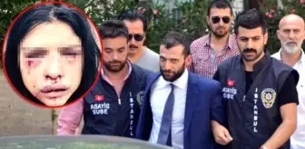 Onur Özbizerdik'in Sevgilisi Konuştu: Bana 'Annem Gibi Öleceksin' Dedi